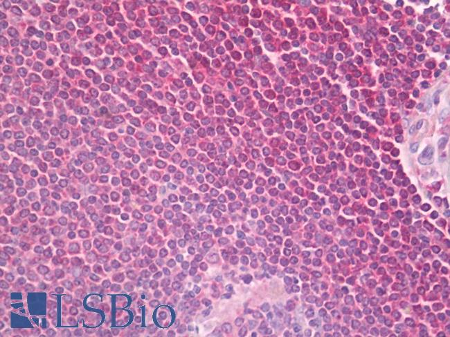 PLCG2 / PLC Gamma 2 Antibody - Anti-PLCG2 antibody IHC of human spleen. Immunohistochemistry of formalin-fixed, paraffin-embedded tissue after heat-induced antigen retrieval. Antibody dilution 1:100.