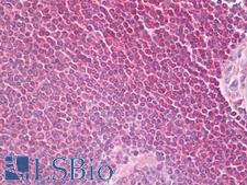 PLCG2 / PLC Gamma 2 Antibody - Anti-PLCG2 antibody IHC of human spleen. Immunohistochemistry of formalin-fixed, paraffin-embedded tissue after heat-induced antigen retrieval. Antibody dilution 1:100.