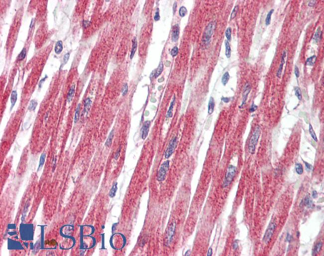 PLCL1 Antibody - Anti-PLCL1 antibody IHC staining of human heart. Immunohistochemistry of formalin-fixed, paraffin-embedded tissue after heat-induced antigen retrieval.