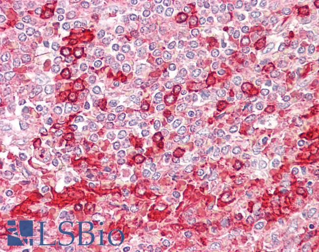 PLD1 / Phospholipase D1 Antibody - Anti-PLD1 antibody IHC of human spleen. Immunohistochemistry of formalin-fixed, paraffin-embedded tissue after heat-induced antigen retrieval. Antibody dilution 1:50.