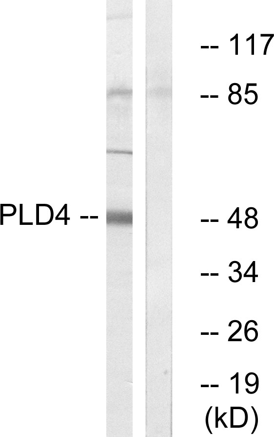 PLD4 / Phospholipase D4 Antibody - Western blot analysis of lysates from Jurkat cells, using PLD4 Antibody. The lane on the right is blocked with the synthesized peptide.