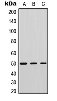 PLD4 / Phospholipase D4 Antibody - Western blot analysis of Phospholipase D4 expression in human tonsil (A); mouse testis (B); mouse muscle (C) whole cell lysates.