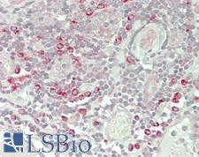 PLD4 / Phospholipase D4 Antibody - Human Tonsil: Formalin-Fixed, Paraffin-Embedded (FFPE)