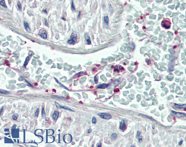 PLEK / Pleckstrin Antibody - Anti-Pleckstrin antibody IHC of human vessel, platelets. Immunohistochemistry of formalin-fixed, paraffin-embedded tissue after heat-induced antigen retrieval. Antibody concentration 75 ug/ml.