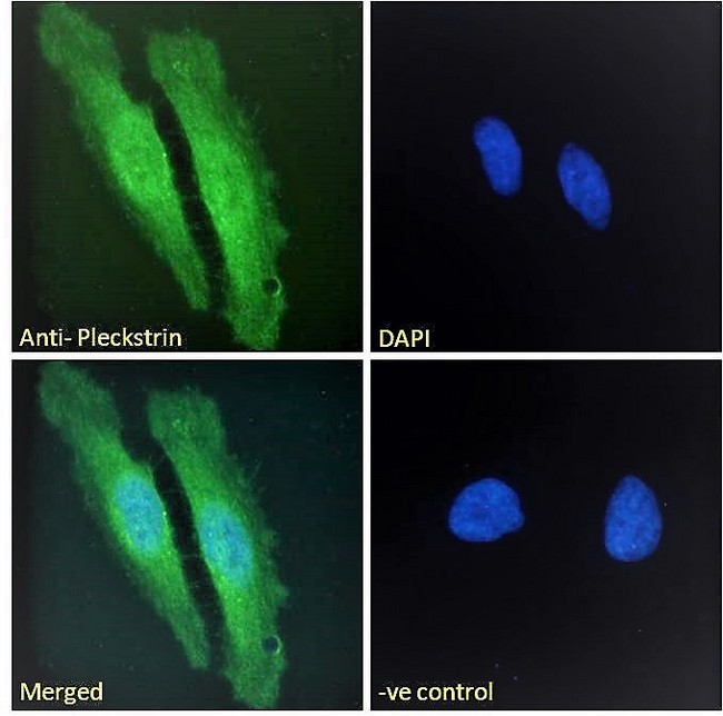 PLEK / Pleckstrin Antibody - Pleckstrin Antibody Immunofluorescence analysis of paraformaldehyde fixed HeLa cells, permeabilized with 0.15% Triton. Primary incubation 1hr (10ug/ml) followed by Alexa Fluor 488 secondary antibody (2ug/ml), showing cytoplasmic/membrane and nuclear staining. The nuclear stain is DAPI (blue). Negative control: Unimmunized goat IgG (10ug/ml) followed by Alexa Fluor 488 secondary antibody (2ug/ml).