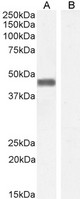 PLEK / Pleckstrin Antibody - Pleckstrin Antibody staining (0.01µg/ml) of Human Parathyroid lysate (A) and negative control HepG2 (B) cell lysate (35µg protein in RIPA buffer). . Detected by chemiluminescencence.