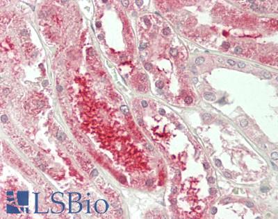 PLEKHJ1 Antibody - Human Kidney: Formalin-Fixed, Paraffin-Embedded (FFPE)