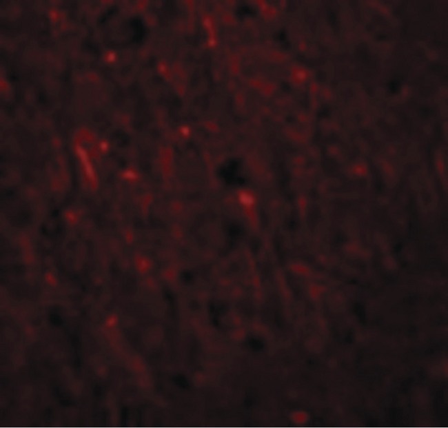 PLEKHM2 / SKIP Antibody - Immunofluorescence of PLEKHM2 in Human Brain cells with PLEKHM2 antibody at 20 ug/ml.