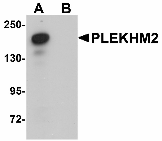 PLEKHM2 / SKIP Antibody - Western blot of PLEKHM2 in rat brain tissue lysate with PLEKHM2 antibody at 0.5 ug/ml in (A) the absence and (B) the presence of blocking peptide. Below: Immunohistochemistry of FAM59A in human liver tissue with FAM59A antibody at 5 ug/ml.