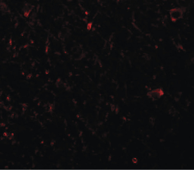 PLEKHM3 Antibody - Immunofluorescence of PLKHM3 in human brain tissue with PLKHM3 antibody at 20 ug/ml.