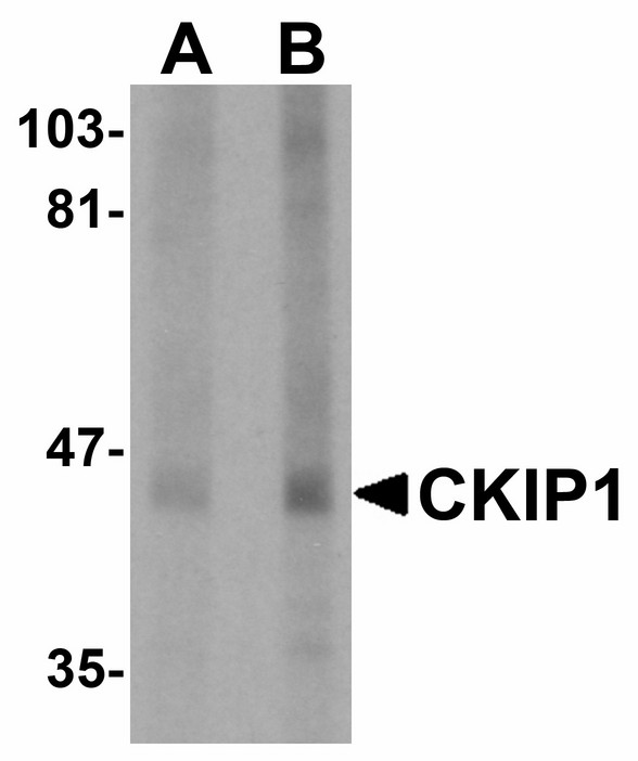 PLEKHO1 / CKIP-1 Antibody - Western blot of CKIP1 in human lung tissue lysate with CKIP1 antibody at (A) 1 and (B) 2 ug/ml.