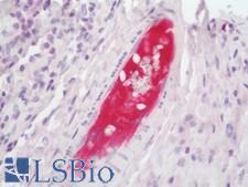 PLG / Plasmin / Plasminogen Antibody - Human Tonsil: Formalin-Fixed, Paraffin-Embedded (FFPE) 