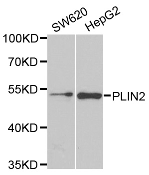 PLIN2 / ADFP / Adipophilin Antibody - Western blot analysis of extracts of various cell lines.