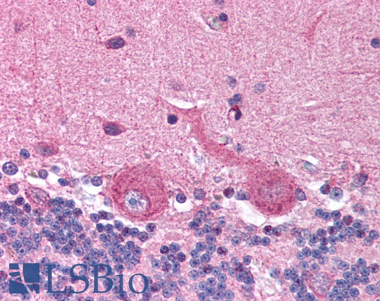 PLIN3 / M6PRBP1 / TIP47 Antibody - Anti-PLIN3 / M6PRBP1 antibody IHC of human brain, cerebellum. Immunohistochemistry of formalin-fixed, paraffin-embedded tissue after heat-induced antigen retrieval. Antibody concentration 5 ug/ml.  This image was taken for the unconjugated form of this product. Other forms have not been tested.