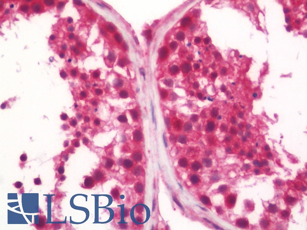 PLIN3 / M6PRBP1 / TIP47 Antibody - Human Testis: Formalin-Fixed, Paraffin-Embedded (FFPE)