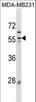 PLIN3 / M6PRBP1 / TIP47 Antibody - Mouse Plin3 Antibody western blot of MDA-MB231 cell line lysates (35 ug/lane). The Mouse Plin3 antibody detected the Mouse Plin3 protein (arrow).