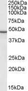 PLIN3 / M6PRBP1 / TIP47 Antibody - Antibody (0.1 ug/ml) staining of Rat Skin lysate (35 ug protein in RIPA buffer). Primary incubation was 1 hour. Detected by chemiluminescence.