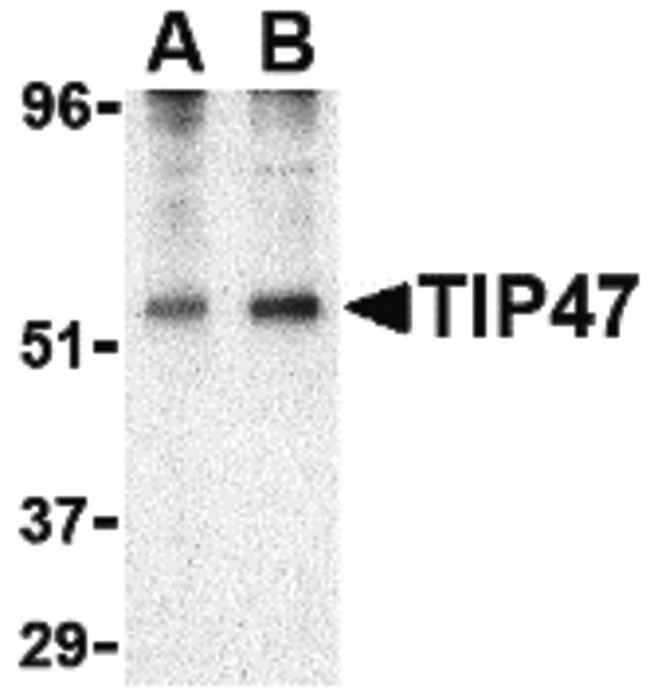 PLIN3 / M6PRBP1 / TIP47 Antibody - Western blot of TIP47 in EL4 cell lysate with TIP47 antibody at (A) 0.5 and (B) 1 ug/ml.