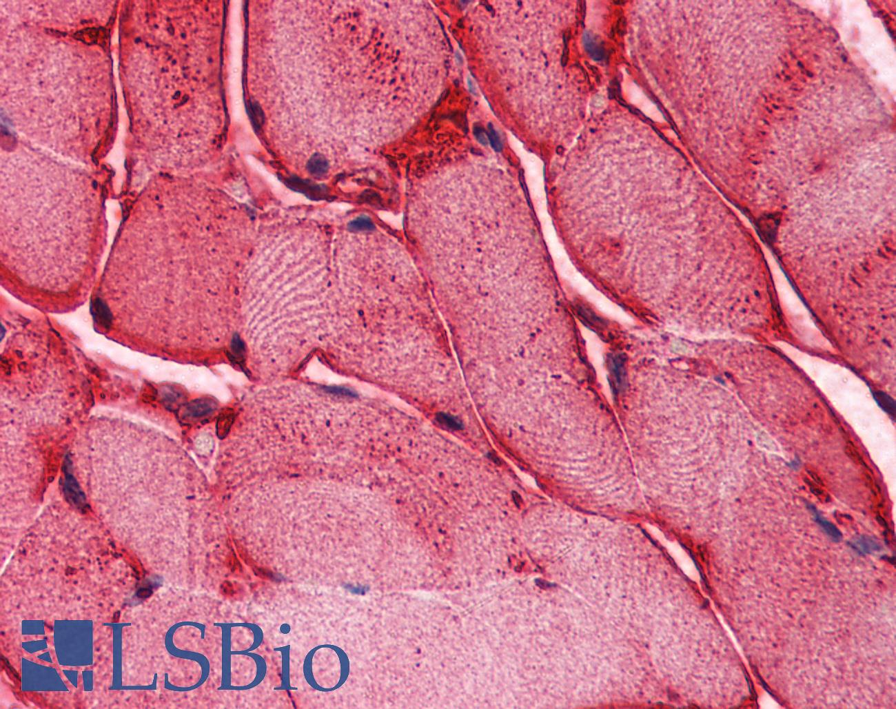 PLIN5 / OXPAT / LSDP5 Antibody - Anti-PLIN5 / LSDP5 antibody IHC of human skeletal muscle. Immunohistochemistry of formalin-fixed, paraffin-embedded tissue after heat-induced antigen retrieval. Antibody concentration 5 ug/ml.  This image was taken for the unconjugated form of this product. Other forms have not been tested.