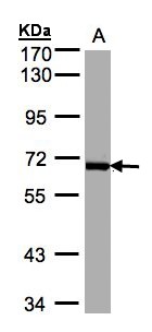 PLK1 / PLK-1 Antibody - Sample(30 ug whole cell lysate). A: Raji. 7.5% SDS PAGE. PLK1 antibody diluted at 1:1000.