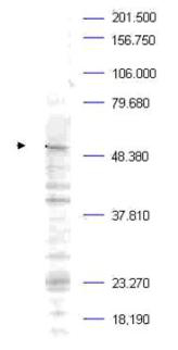 PLK1 / PLK-1 Antibody - Anti-Plk-1 pT210 Antibody - Western Blot. Western blot analysis is shown using Affinity Purified anti-Plk-1 pT210 antibody to detect endogenous protein present in a Mouse A20 whole cell lysate (arrowhead). Comparison to a molecular weight marker indicates a band of ~68 kD corresponding to Plk-1 protein. It is suggested to use a nuclear extract from synchronized cells to greatly increase the abundance of this protein in preparations. The blot was incubated with a 1:500 dilution of the antibody at room temperature followed by detection using standard techniques. Personal communication Steven Pelech, Kinexus Inc. Vancouver, BC.
