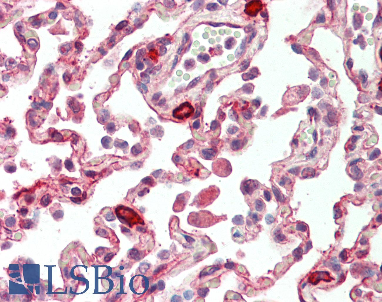PLK3 Antibody - Huma Lung: Formalin-Fixed, Paraffin-Embedded (FFPE)