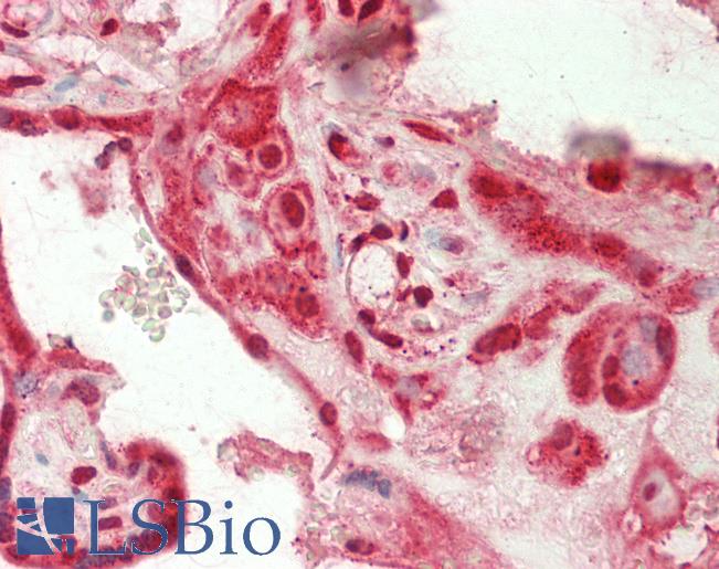 PLTP Antibody - Human Placenta: Formalin-Fixed, Paraffin-Embedded (FFPE)