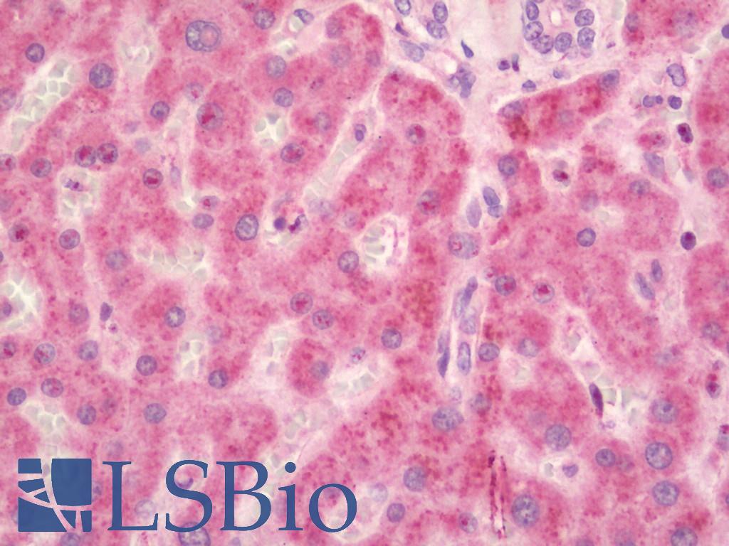 PLTP Antibody - Human Liver: Formalin-Fixed, Paraffin-Embedded (FFPE).  This image was taken for the unconjugated form of this product. Other forms have not been tested.