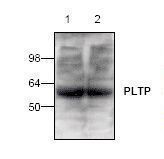 PLTP Antibody - Western blot of PLTP antibody using Jurkat cell extracts.