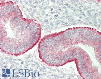 PLXNA4 / Plexin A4 Antibody - Human Uterus: Formalin-Fixed, Paraffin-Embedded (FFPE)