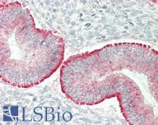 PLXNA4 / Plexin A4 Antibody - Human Uterus: Formalin-Fixed, Paraffin-Embedded (FFPE)