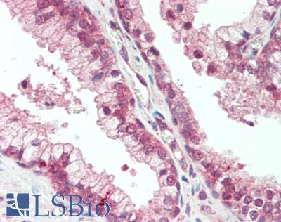 PLXNB1 / Plexin-B1 Antibody - Human Prostate: Formalin-Fixed, Paraffin-Embedded (FFPE), at a concentration of 10 ug/ml. 