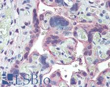 PLXNB1 / Plexin-B1 Antibody - Human Placenta: Formalin-Fixed, Paraffin-Embedded (FFPE)