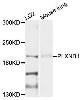 PLXNB1 / Plexin-B1 Antibody - Western blot analysis of extracts of various cell lines, using PLXNB1 antibody at 1:1000 dilution. The secondary antibody used was an HRP Goat Anti-Rabbit IgG (H+L) at 1:10000 dilution. Lysates were loaded 25ug per lane and 3% nonfat dry milk in TBST was used for blocking. An ECL Kit was used for detection and the exposure time was 60s.