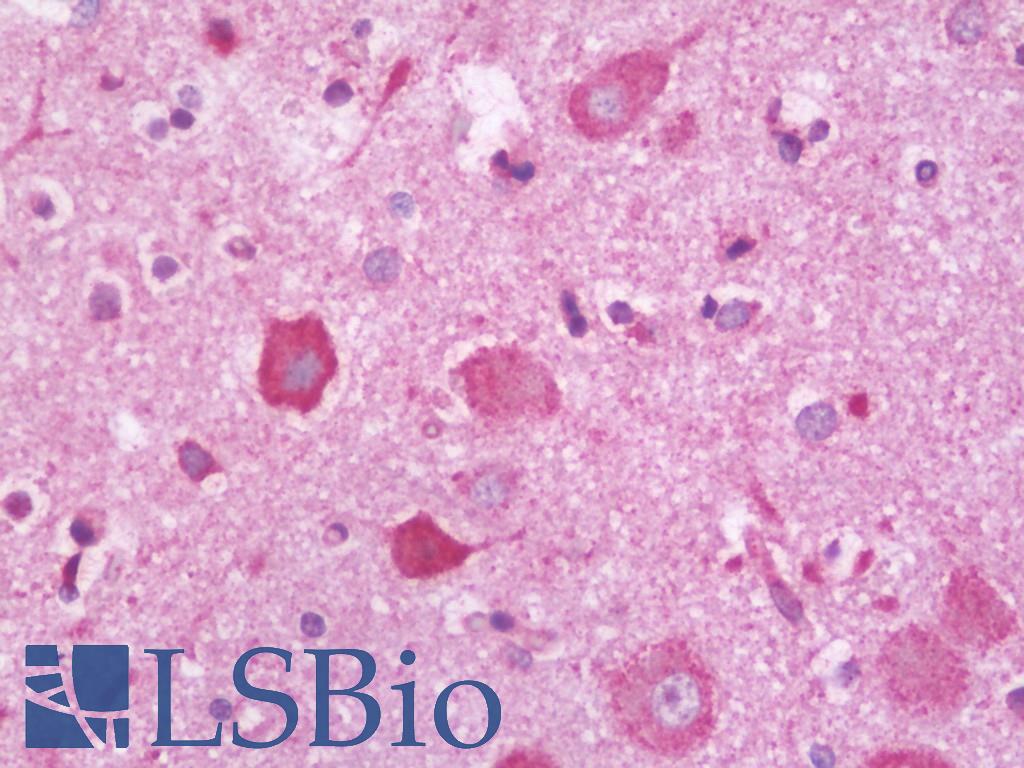 PLXNC1 / Plexin C1 Antibody - Anti-PLXNC1 / Plexin C1 antibody IHC staining of human brain, cortex. Immunohistochemistry of formalin-fixed, paraffin-embedded tissue after heat-induced antigen retrieval. Antibody dilution 1:100.