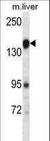 PLXNC1 / Plexin C1 Antibody - PLXNC1 Antibody western blot of mouse liver tissue lysates (35 ug/lane). The PLXNC1 antibody detected the PLXNC1 protein (arrow).