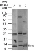 PMAIP1 / NOXA Antibody - Western blot of Noxa in A) human, B) mouse, and C) rat thymus tissue using antibody at 2 ug/ml.