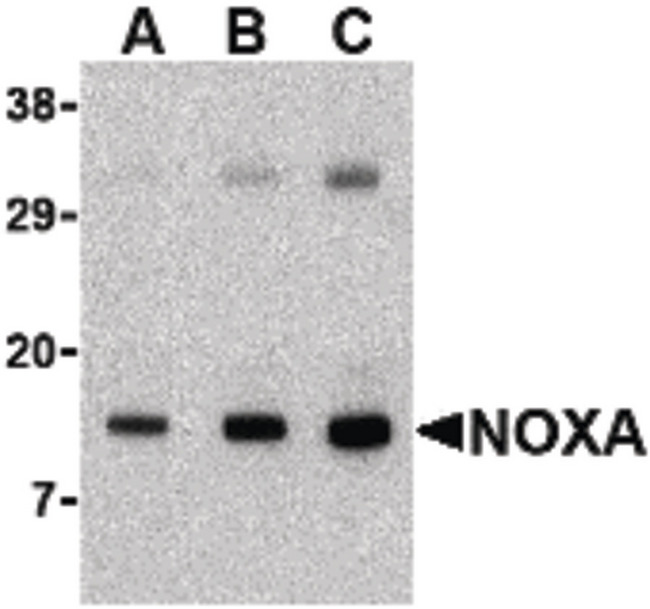 PMAIP1 / NOXA Antibody - Western blot of Noxa in human stomach tissue lysate with Noxa antibody at (A) 0.5, (B) 1 and (C) 2 ug/ml.