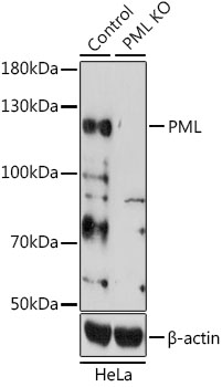 PML Antibody - Western blot analysis of extracts from normal (control) and PML knockout (KO) HeLa cells, using PML antibodyat 1:1000 dilution. The secondary antibody used was an HRP Goat Anti-Rabbit IgG (H+L) at 1:10000 dilution. Lysates were loaded 25ug per lane and 3% nonfat dry milk in TBST was used for blocking. An ECL Kit was used for detection and the exposure time was 90s.