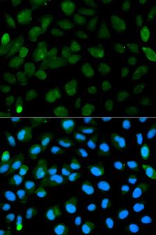 PML Antibody - Immunofluorescence analysis of HeLa cells using PML antibody. Blue: DAPI for nuclear staining.