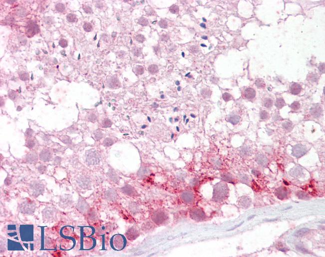 PMP70 Antibody - Anti-ABCD3 / PMP70 antibody IHC of human testis. Immunohistochemistry of formalin-fixed, paraffin-embedded tissue after heat-induced antigen retrieval. Antibody concentration 2.5 ug/ml.
