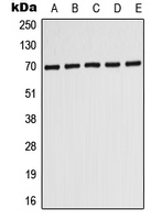 PMP70 Antibody - Western blot analysis of ABCD3 expression in HepG2 (A); MCF7 (B); SHSY5Y (C); SP2/0 (D); PC12 (E) whole cell lysates.