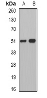 PNLIP / PL / Pancreatic Lipase Antibody - Western blot analysis of Pancreatic Lipase expression in mouse liver (A); mouse pancreas (B) whole cell lysates.