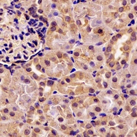 PNLIP / PL / Pancreatic Lipase Antibody - Immunohistochemical analysis of Pancreatic Lipase staining in rat kidney formalin fixed paraffin embedded tissue section. The section was pre-treated using heat mediated antigen retrieval with sodium citrate buffer (pH 6.0). The section was then incubated with the antibody at room temperature and detected using an HRP conjugated compact polymer system. DAB was used as the chromogen. The section was then counterstained with hematoxylin and mounted with DPX.