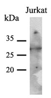 PNMT Antibody - Western Blot: The cell lysates (40 ug) were resolved by SDS-PAGE, transferred to PVDF membrane and probed with anti-human PNMT antibody (1:500). Proteins were visualized using a goat anti-mouse secondary antibody conjugated to HRP and an ECL detection system.