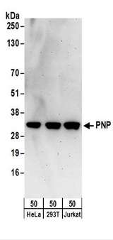 PNP / Nucleoside Phosphorylase Antibody - Detection of Human PNP by Western Blot. Samples: Whole cell lysate (50 ug) from HeLa, 293T, and Jurkat cells. Antibodies: Affinity purified rabbit anti-PNP antibody used for WB at 0.1 ug/ml. Detection: Chemiluminescence with an exposure time of 3 minutes.