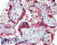 PNP / Nucleoside Phosphorylase Antibody - Human Placenta: Formalin-Fixed, Paraffin-Embedded (FFPE), at a concentration of 5 ug/ml. 