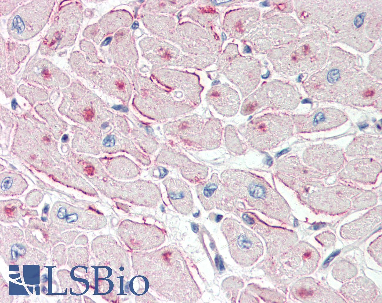 PNPLA2 / ATGL Antibody - Anti-PNPLA2 / ATGL antibody IHC of human heart. Immunohistochemistry of formalin-fixed, paraffin-embedded tissue after heat-induced antigen retrieval. Antibody concentration 5 ug/ml.