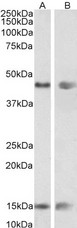 PNPLA3 / Adiponutrin Antibody - PNPLA3 / Adiponutrin antibody (0.01µg/ml) staining of Mouse (A) and Rat (B) Adrenal gland lysate (35µg protein in RIPA buffer). Detected by chemiluminescence.