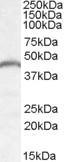 PNPLA3 / Adiponutrin Antibody - PNPLA3 / Adiponutrin antibody (0.05µg/ml) staining of Mouse Heart lysate (35µg protein in RIPA buffer). Detected by chemiluminescence.